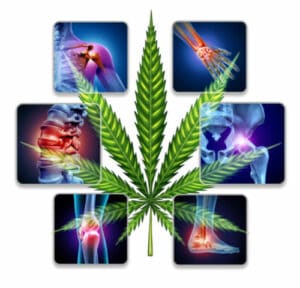 Top Medical Conditions to qualify for marijuana in Ohio